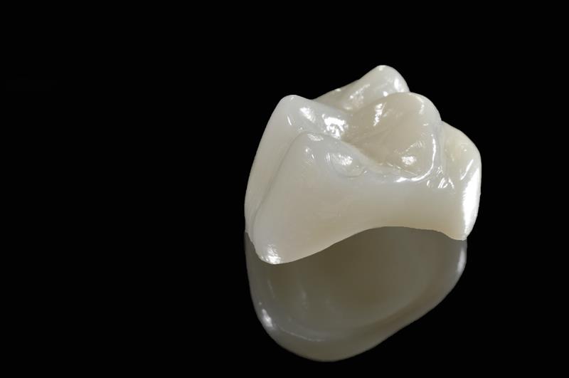 Porcelain Crowns Alpharetta, GA